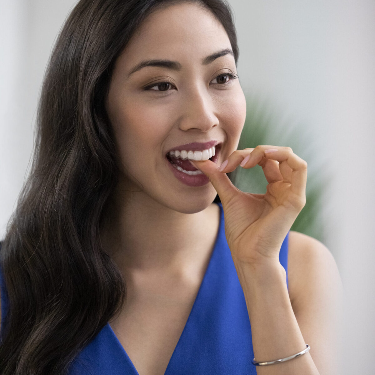 Invisalign, Everything you need to know, DIAMOND Apex Invisalign provider, dentalbox