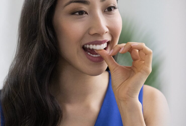 Invisalign, Everything you need to know, DIAMOND Apex Invisalign provider, dentalbox