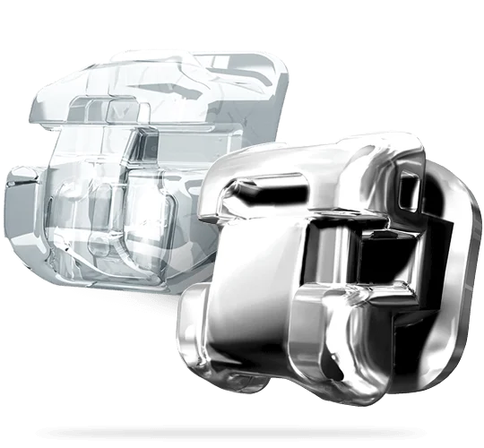 Orthodontics Fixed braces tunbridge wells